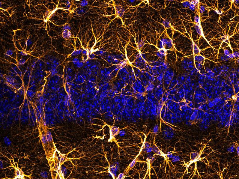 Astrocytes de souris atteintes par la maladie d’Alzheimer. Les astrocytes modifiés génétiquement permettent aux neurones de survivre à la maladie d’Alzheimer. Les souris ainsi traitées ne perdent pas la mémoire. Photo: Département des neurosciences fondamentales © UNIL