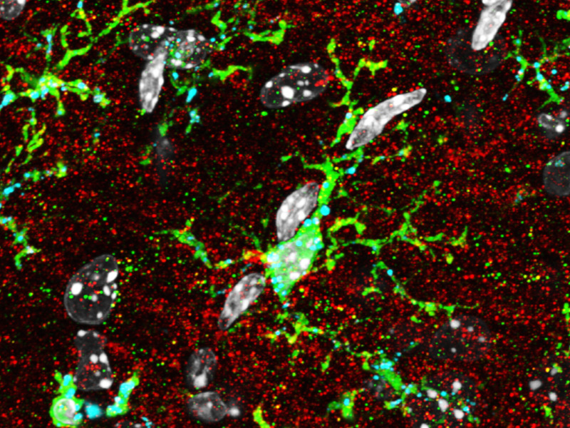 Et si la maladie d’Alzheimer trouvait ses racines dans l'enfance?